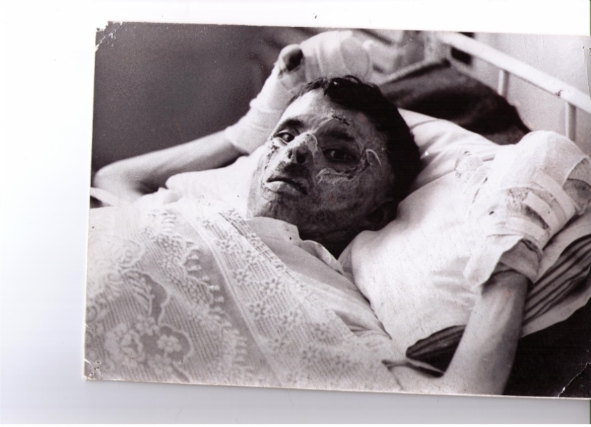 f:\soldat_brûlé_au_napalm_dans_un_hôpital_militaire.jpg