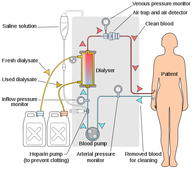 http://www.infodokterku.com/images/stories/skema-hemodialysis%20dari%20wikipedia.png