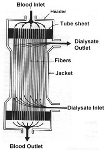 http://www.infodokterku.com/images/stories/dialyzer.jpg
