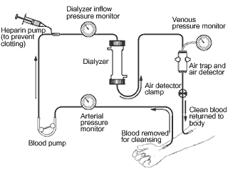http://www.infodokterku.com/images/stories/dialysis%20schema.gif