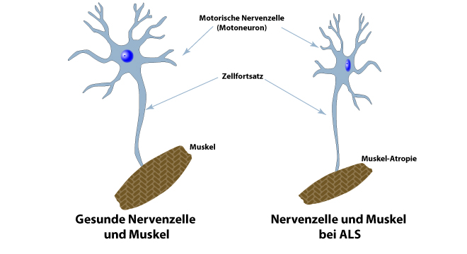http://www.tellmed.ch/show_image.php?file_id=5284