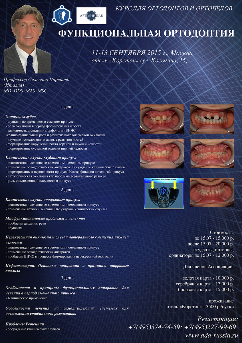 http://dda-russia.ru/sites/default/files/naretto.jpg