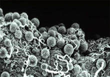 http://www.malariasite.com/malaria/oocysts.gif